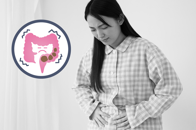 便秘とは？｜日数だけが基準ではありません