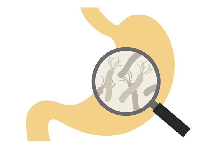 慢性胃炎・萎縮性胃炎の治療